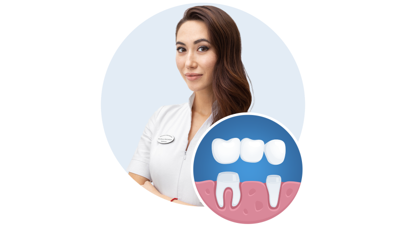 Hammaste proteesimine